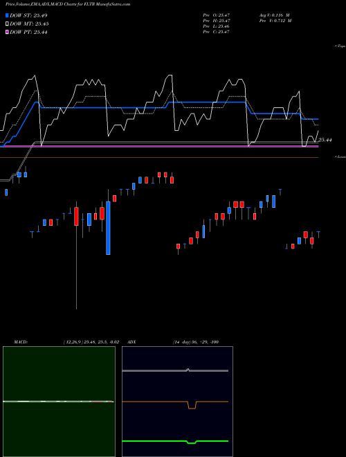MACD charts various settings share FLTR Market Vectors Investment Grade AMEX Stock exchange 