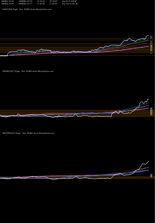 Trend of Electromed Inc ELMD TrendLines Electromed Inc ELMD share AMEX Stock Exchange 