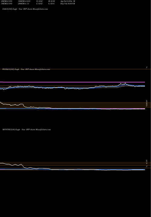 Trend of Retractable Technologies RVP TrendLines Retractable Technologies RVP share AMEX Stock Exchange 