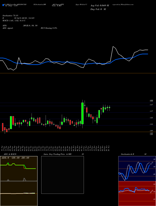 Chart Apyx Medical (APYX)  Technical (Analysis) Reports Apyx Medical [