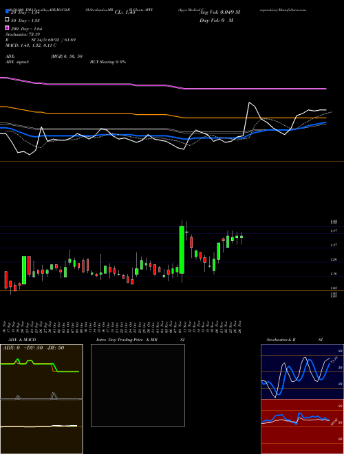 Apyx Medical Corporation APYX Support Resistance charts Apyx Medical Corporation APYX NASDAQ