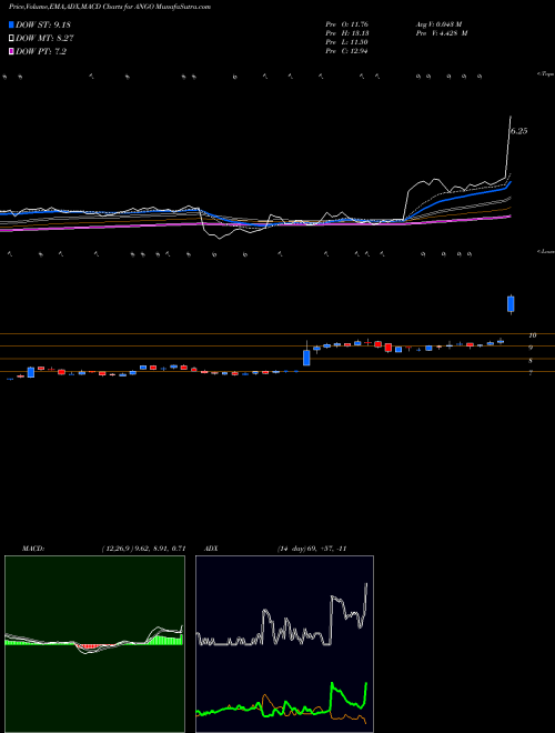 MACD charts various settings share ANGO AngioDynamics, Inc. NASDAQ Stock exchange 