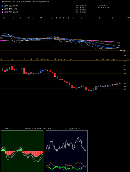MACD charts various settings share CNXC Concentrix Corporation NASDAQ Stock exchange 