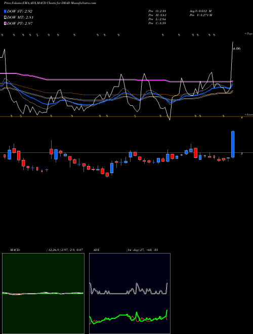 MACD charts various settings share DRAD Digirad Corporation NASDAQ Stock exchange 