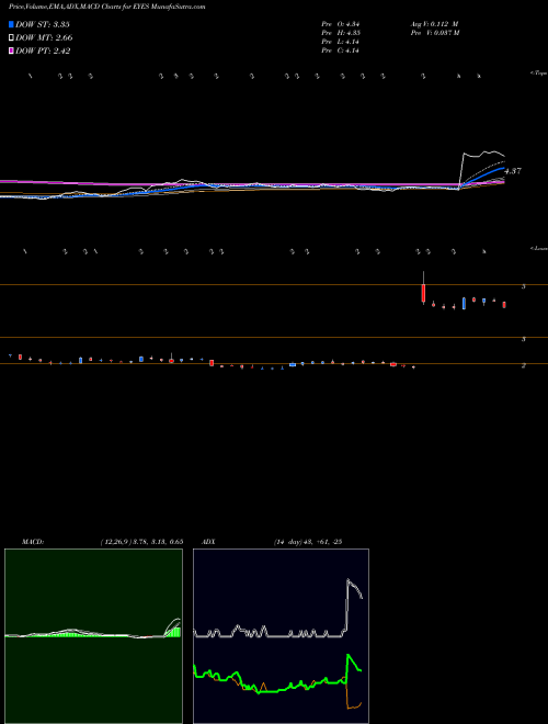 MACD charts various settings share EYES Second Sight Medical Products, Inc. NASDAQ Stock exchange 