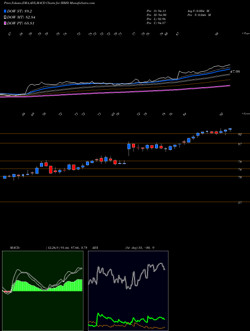 MACD charts various settings share IRMD IRadimed Corporation NASDAQ Stock exchange 