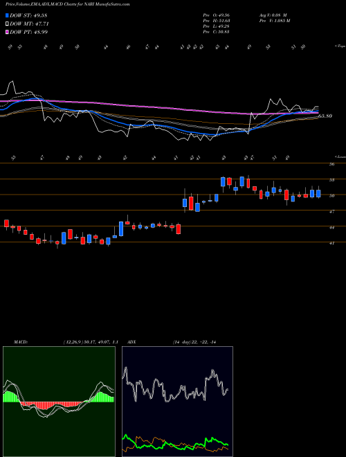 Munafa Inari Medical Inc (NARI) stock tips, volume analysis, indicator analysis [intraday, positional] for today and tomorrow