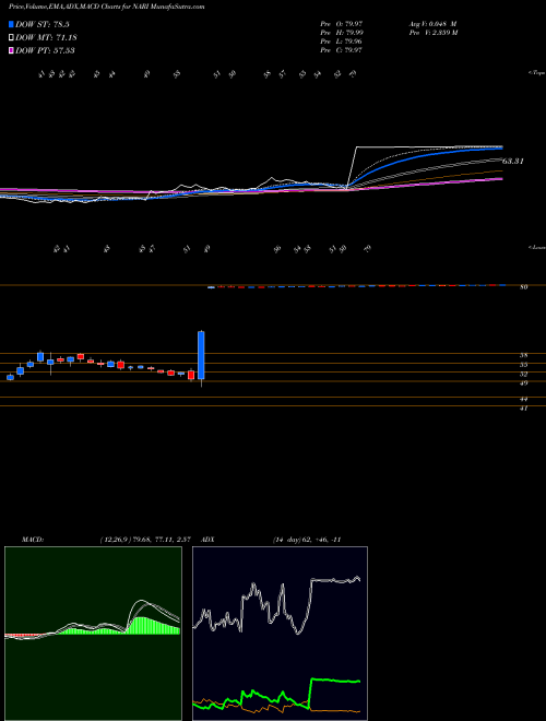 MACD charts various settings share NARI Inari Medical Inc NASDAQ Stock exchange 