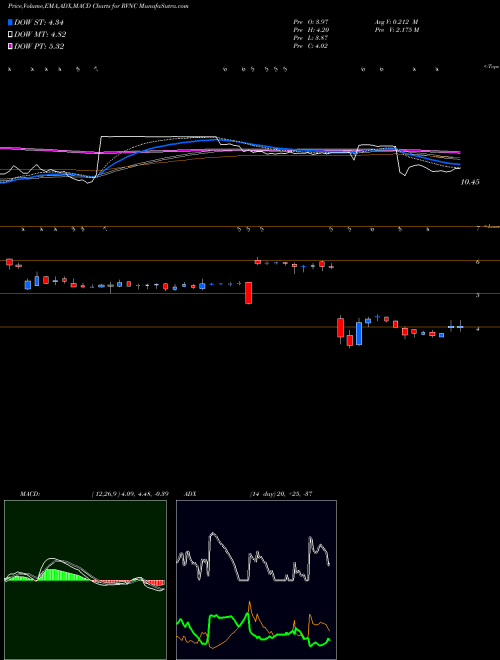 MACD charts various settings share RVNC Revance Therapeutics, Inc. NASDAQ Stock exchange 