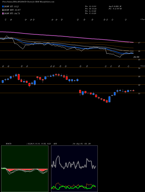 MACD charts various settings share XRAY DENTSPLY SIRONA Inc. NASDAQ Stock exchange 