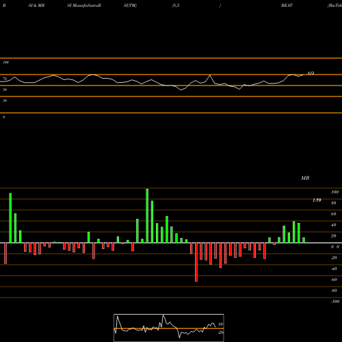 RSI & MRSI charts BioTelemetry, Inc. BEAT share NASDAQ Stock Exchange 