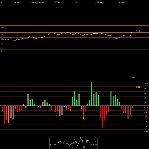 RSI & MRSI charts Digirad Corporation DRAD share NASDAQ Stock Exchange 