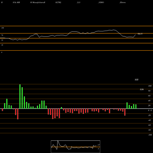 RSI & MRSI charts Eleven Biotherapeutics, Inc. EBIO share NASDAQ Stock Exchange 
