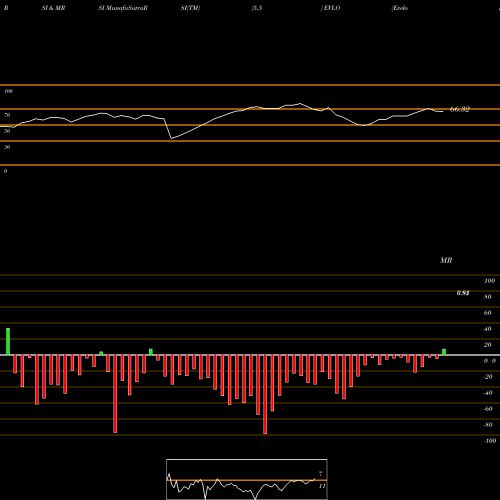 RSI & MRSI charts Evelo Biosciences, Inc. EVLO share NASDAQ Stock Exchange 