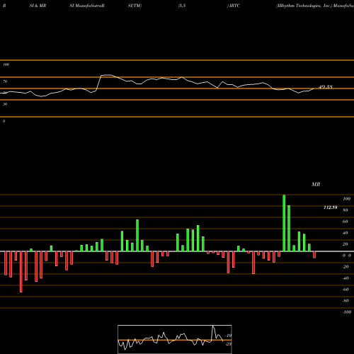 RSI & MRSI charts IRhythm Technologies, Inc. IRTC share NASDAQ Stock Exchange 