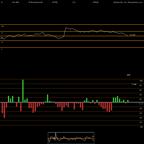 RSI & MRSI charts MyoKardia, Inc. MYOK share NASDAQ Stock Exchange 
