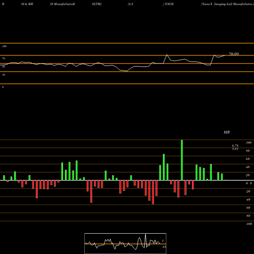 RSI & MRSI charts Nano-X Imaging Ltd NNOX share NASDAQ Stock Exchange 