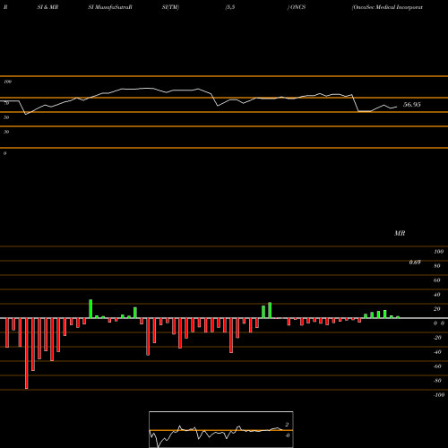 RSI & MRSI charts OncoSec Medical Incorporated ONCS share NASDAQ Stock Exchange 