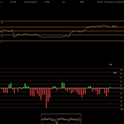 RSI & MRSI charts Revance Therapeutics, Inc. RVNC share NASDAQ Stock Exchange 