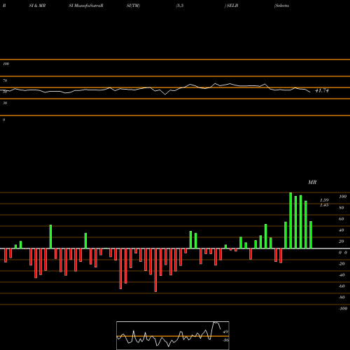 RSI & MRSI charts Selecta Biosciences, Inc. SELB share NASDAQ Stock Exchange 