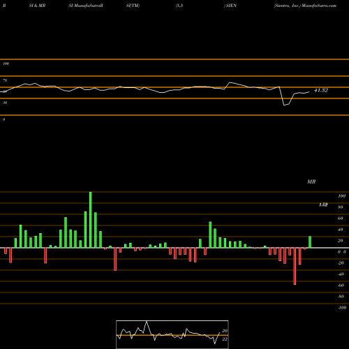 RSI & MRSI charts Sientra, Inc. SIEN share NASDAQ Stock Exchange 