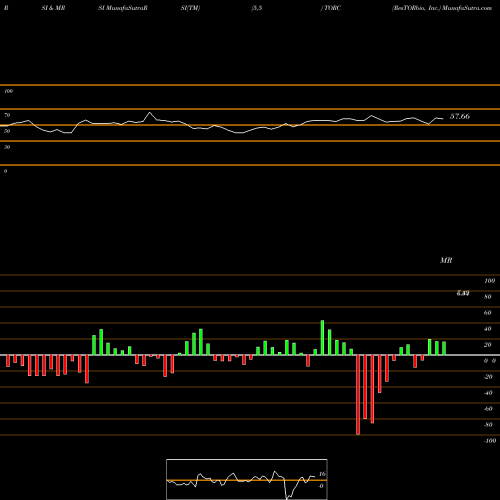 RSI & MRSI charts ResTORbio, Inc. TORC share NASDAQ Stock Exchange 