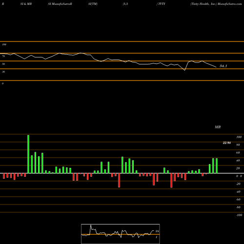 RSI & MRSI charts Tivity Health, Inc. TVTY share NASDAQ Stock Exchange 