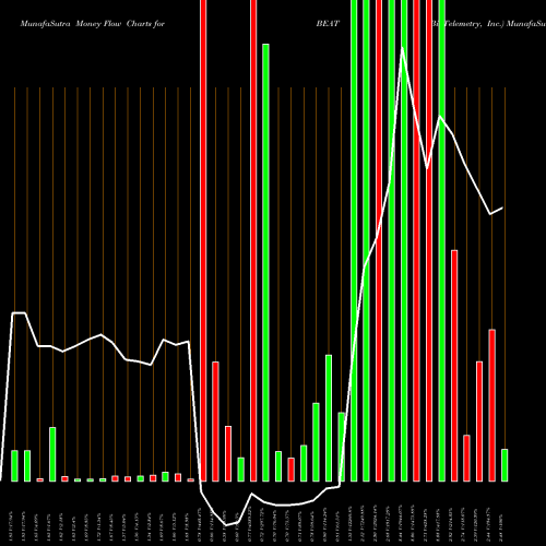 Money Flow charts share BEAT BioTelemetry, Inc. NASDAQ Stock exchange 