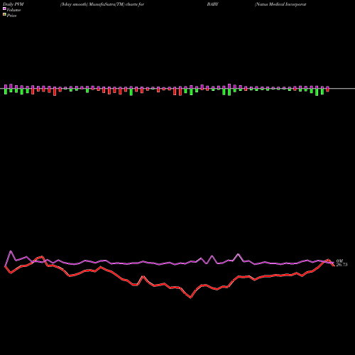 PVM Price Volume Measure charts Natus Medical Incorporated BABY share NASDAQ Stock Exchange 