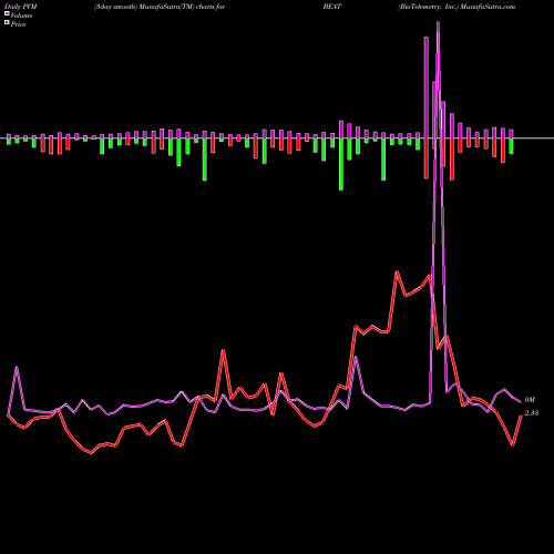 PVM Price Volume Measure charts BioTelemetry, Inc. BEAT share NASDAQ Stock Exchange 