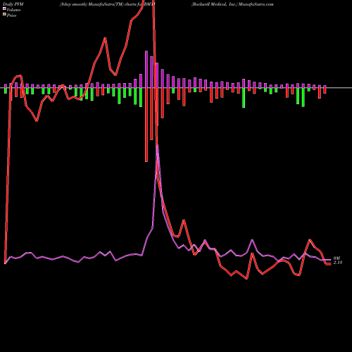 PVM Price Volume Measure charts Rockwell Medical, Inc. RMTI share NASDAQ Stock Exchange 