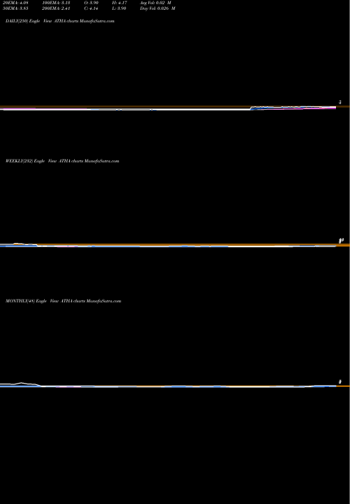 Trend of Athira Pharma ATHA TrendLines Athira Pharma Inc ATHA share NASDAQ Stock Exchange 