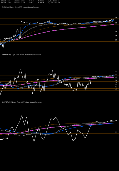 Trend of Axonics Modulation AXNX TrendLines Axonics Modulation Technologies, Inc. AXNX share NASDAQ Stock Exchange 