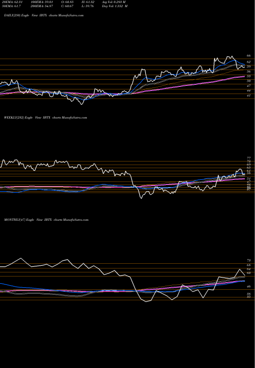 Trend of Independent Bank IBTX TrendLines Independent Bank Group, Inc IBTX share NASDAQ Stock Exchange 