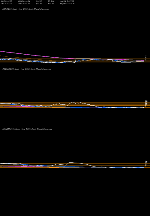 Trend of Revance Therapeutics RVNC TrendLines Revance Therapeutics, Inc. RVNC share NASDAQ Stock Exchange 