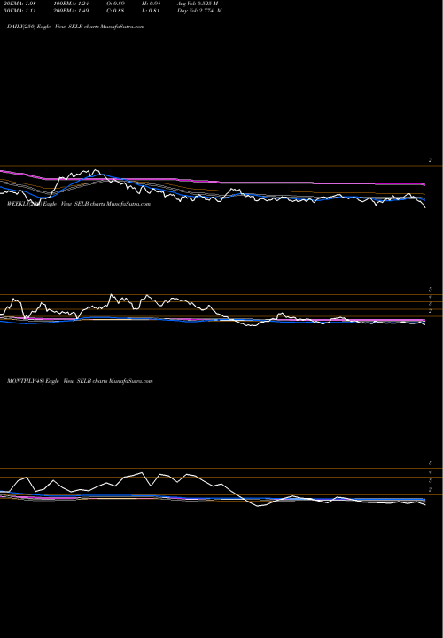 Trend of Selecta Biosciences SELB TrendLines Selecta Biosciences, Inc. SELB share NASDAQ Stock Exchange 