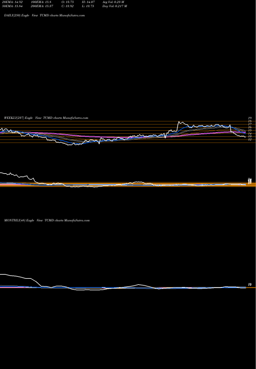 Trend of Tactile Systems TCMD TrendLines Tactile Systems Technology, Inc. TCMD share NASDAQ Stock Exchange 