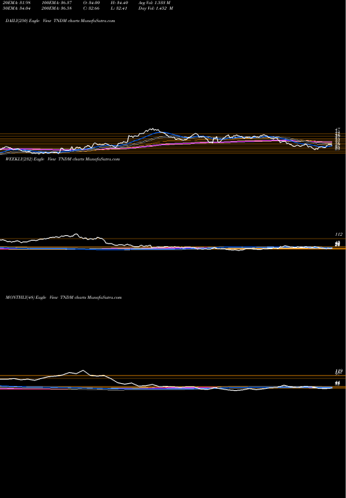 Trend of Tandem Diabetes TNDM TrendLines Tandem Diabetes Care, Inc. TNDM share NASDAQ Stock Exchange 