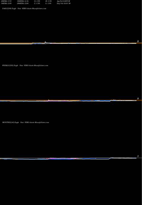 Trend of Venus Concept VERO TrendLines Venus Concept Inc VERO share NASDAQ Stock Exchange 