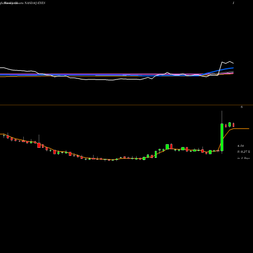 Weekly charts share EYES Second Sight Medical Products, Inc. NASDAQ Stock exchange 