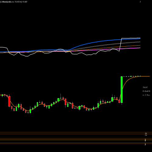 Weekly charts share NARI Inari Medical Inc NASDAQ Stock exchange 