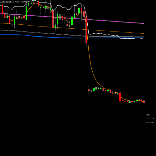 Weekly charts share OTIC Otonomy, Inc. NASDAQ Stock exchange 