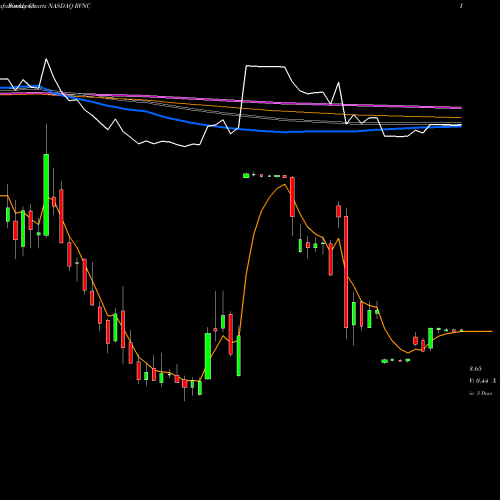 Weekly charts share RVNC Revance Therapeutics, Inc. NASDAQ Stock exchange 