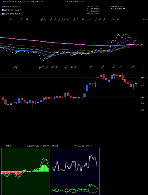 MACD charts various settings share ARTEMISMED Artemis Med Service Ltd NSE Stock exchange 