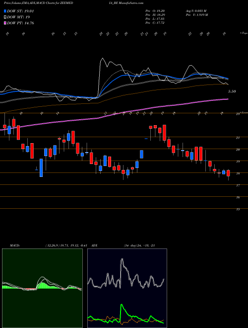 MACD charts various settings share ZEEMEDIA_BE Zee Media Corporation Ltd NSE Stock exchange 