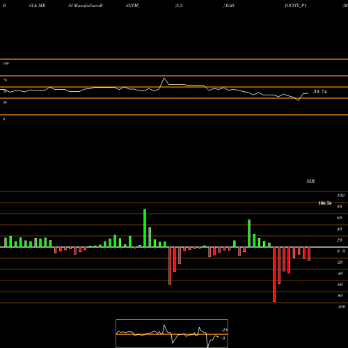 RSI & MRSI charts Music Broadcast Limited RADIOCITY_P1 share NSE Stock Exchange 
