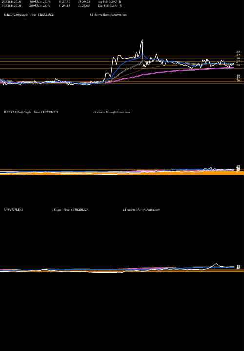 Trend of Cyber Media CYBERMEDIA TrendLines Cyber Media (India) Limited CYBERMEDIA share NSE Stock Exchange 