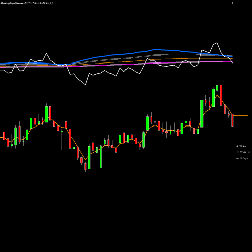 Weekly charts share INDRAMEDCO Indraprastha Medical Corporation Limited NSE Stock exchange 