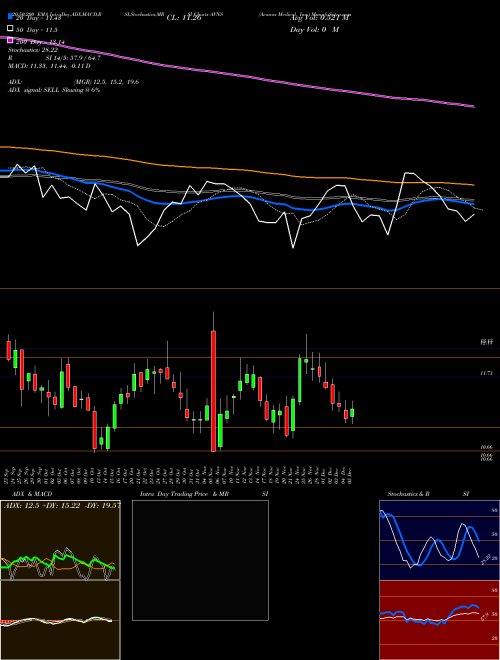 Avanos Medical, Inc. AVNS Support Resistance charts Avanos Medical, Inc. AVNS NYSE