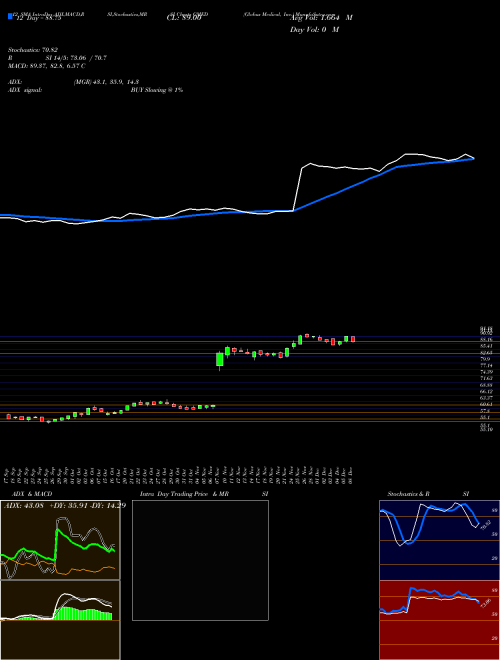 Chart Globus Medical (GMED)  Technical (Analysis) Reports Globus Medical [